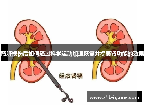 肾脏损伤后如何通过科学运动加速恢复并提高肾功能的效果 肾脏损伤后如何通过科学运动加速恢复并提高肾功能的效果